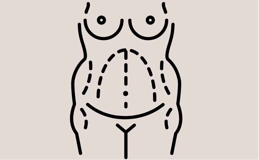 Breast cost