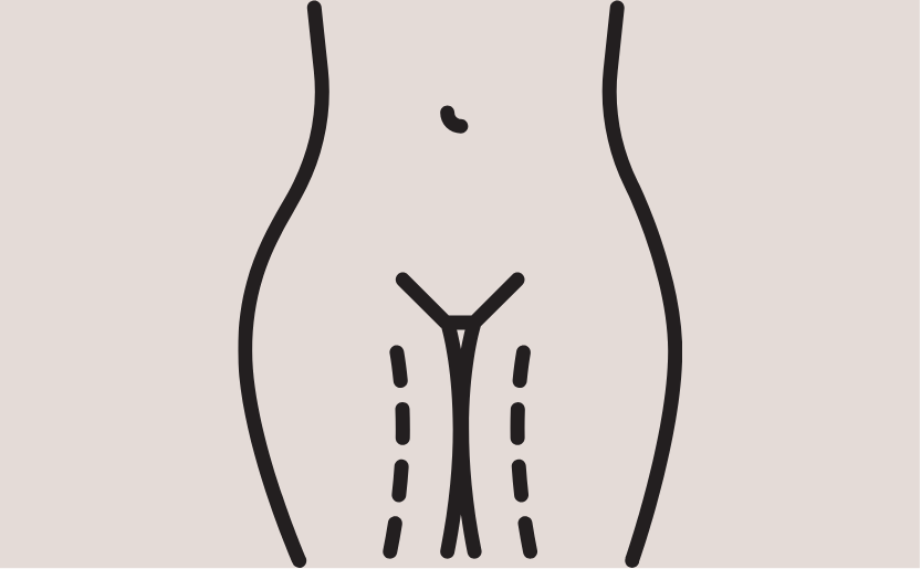 Breast cost